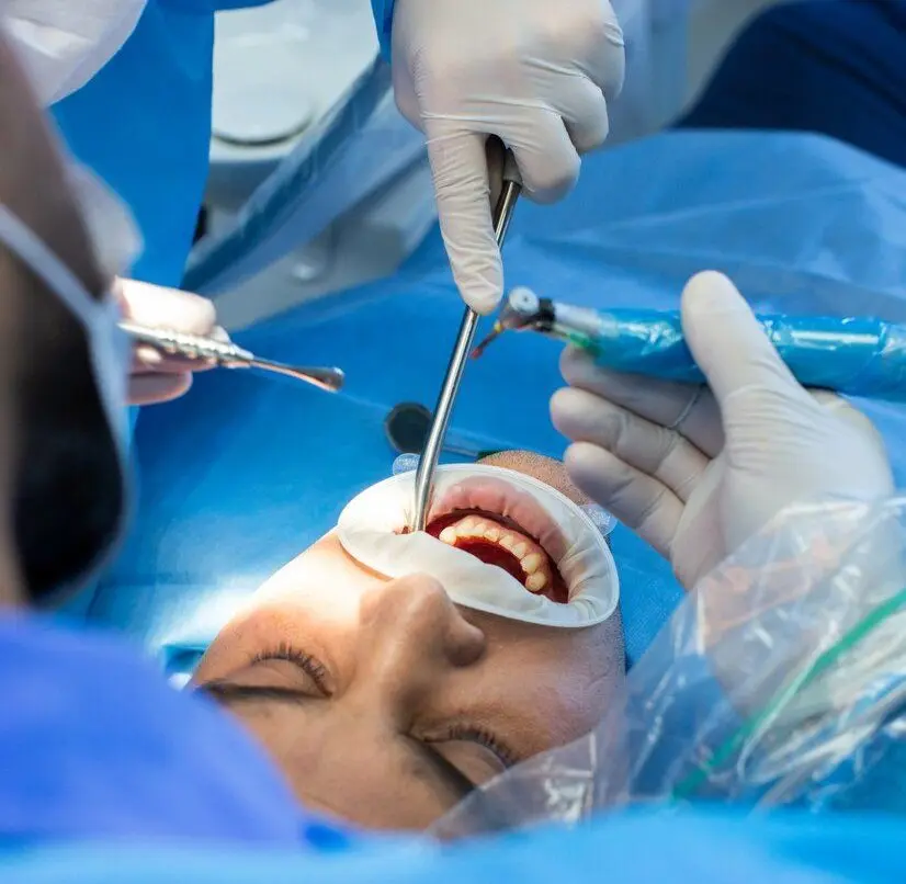 Seen from above: a patient draped in blue with a lip retractor in place, eyes closed, and two pairs of gloved hands above — one with a mirror, the other with a surgical handpiece